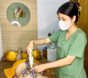 Giác hơi chẩn đoán (Bản đồ giác chẩn)